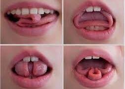 Tongue Trixie's Trick