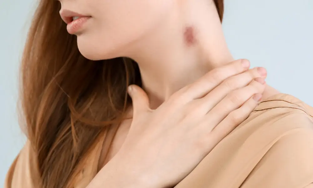 When skin tells secrets: handling unexpected marks with confidence